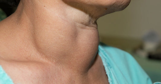 Best Thyroid Teas in India as in 2021