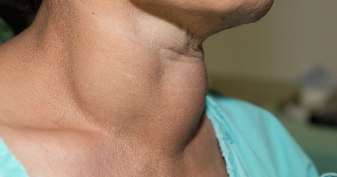 Best Thyroid Teas in India as in 2021