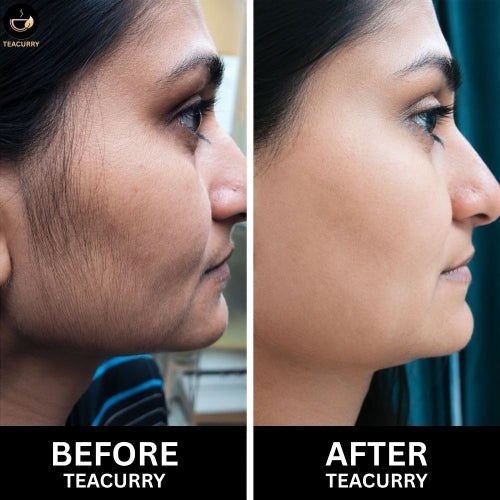 Teacurry Facial Hair Tea - Women Before & After