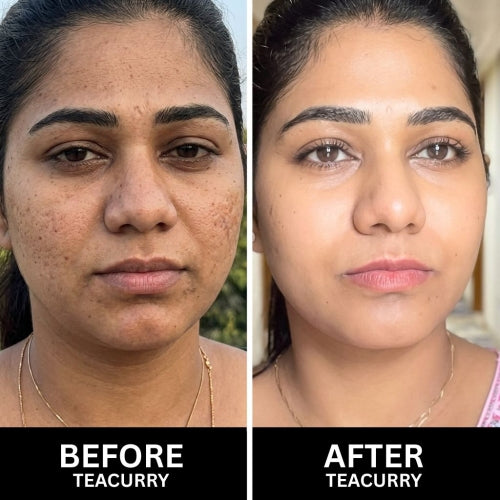 Teacurry Skin Glow Tea - Women Before & After