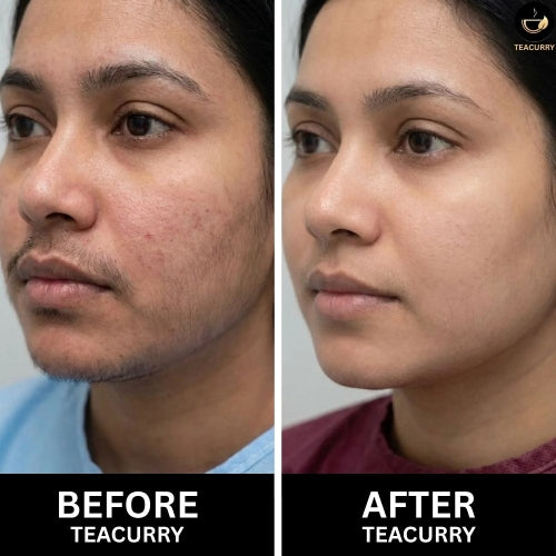Teacurry Facial Hair Tea - Women Before and After