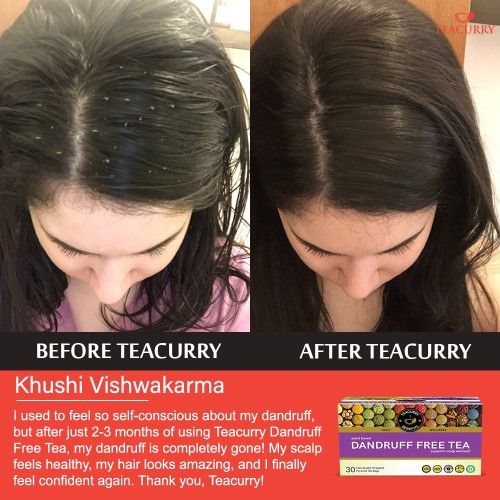 Teacurry Anti Dandruff Tea Before and After