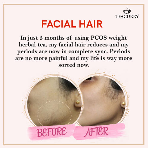 Teacurry Facial Hair Tea Before and After