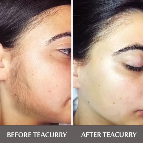 Teacurry Facial Hair Removal Tea Before and After