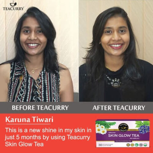 Teacurry Skin Glow Tea - Before After Use By karuna Tiwari