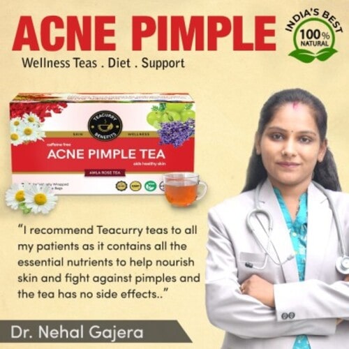 Acne pimple tea recommended by Dr. Neha Gajera