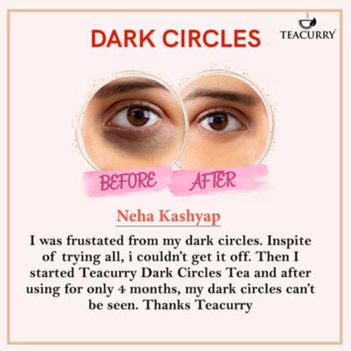 after before use of teacurry dark circles tea