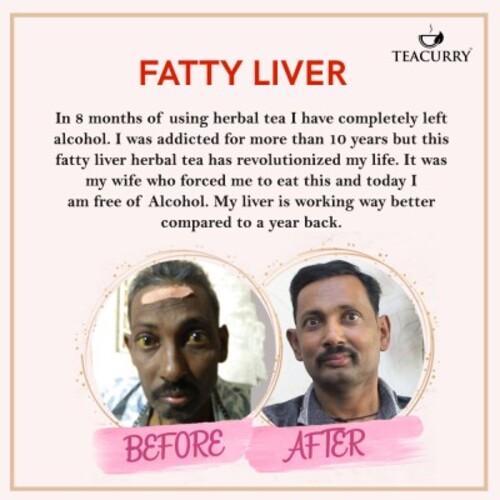 Teacurry Fatty Liver Tea Before and After
