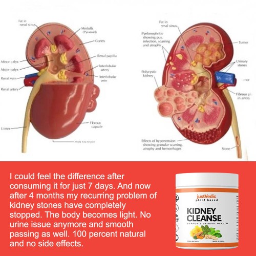 How Justvedic Kidney cleanse Drink mix beneficial for kidneys